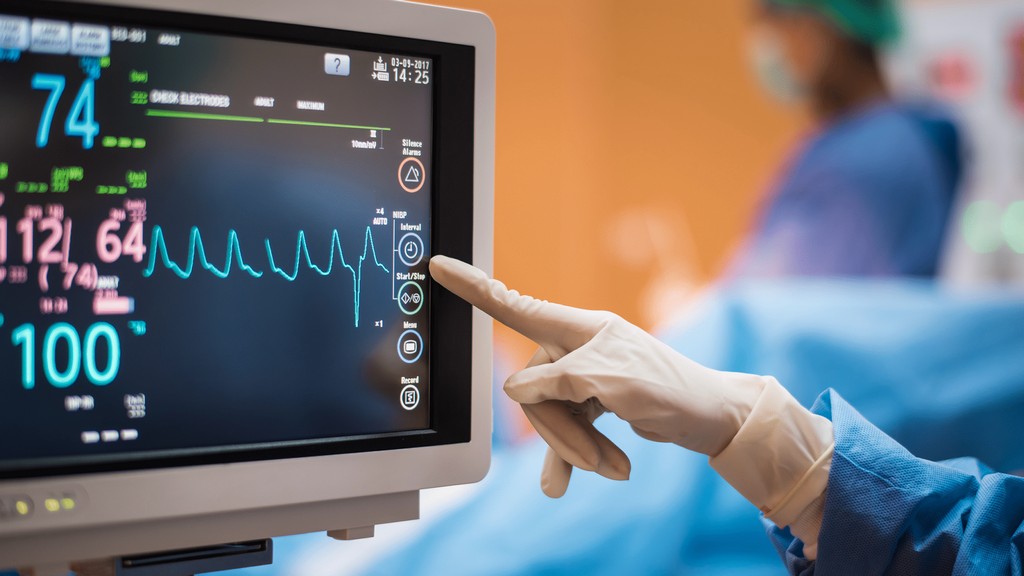 EKG Cihazları
