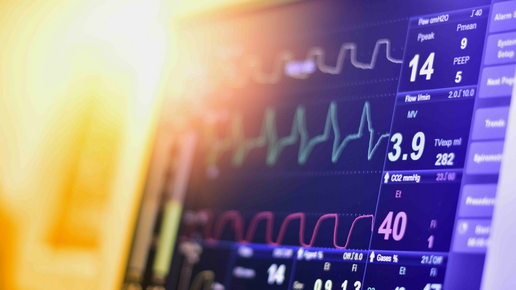 Ekg Monitörleri