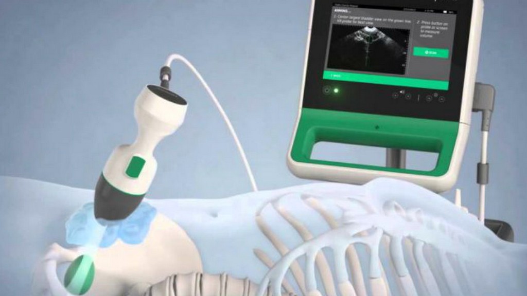 Bladder Scanner