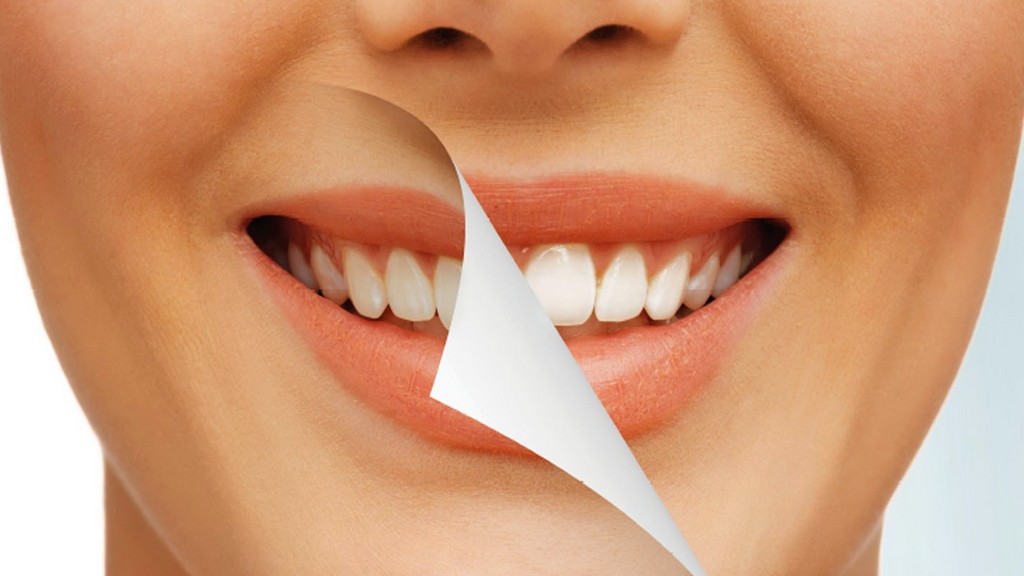 Dental Diş Beyazlatma Cihazları