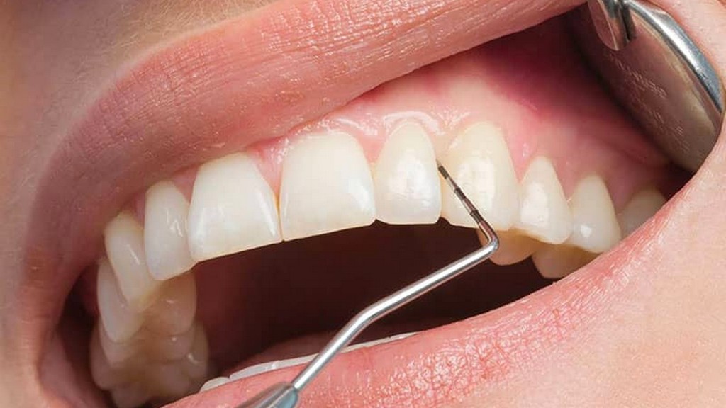 Dental Periodontoloji Ürünleri