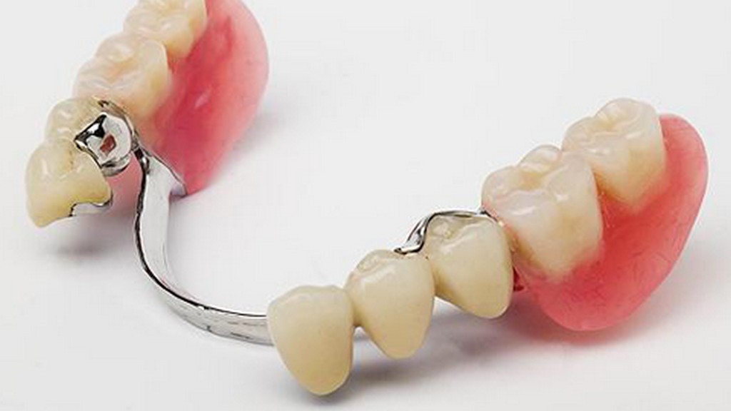 Aldash haqida nemis porno filmlar Uxlash jinsiy filmlar