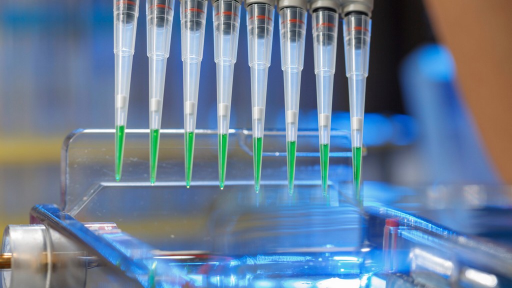 Dijital Elektroforez Dokümantasyon Sistemi