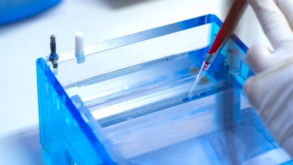 Dna/Rna Elektroforez Sistemi