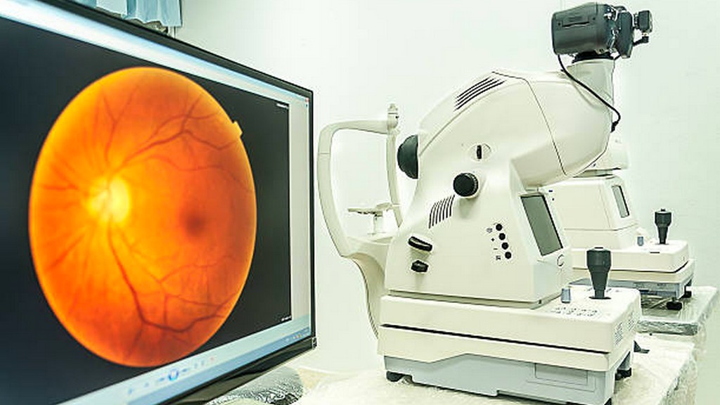 Fundus Kamerası