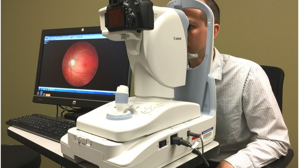 Göz Fundus Kameraları