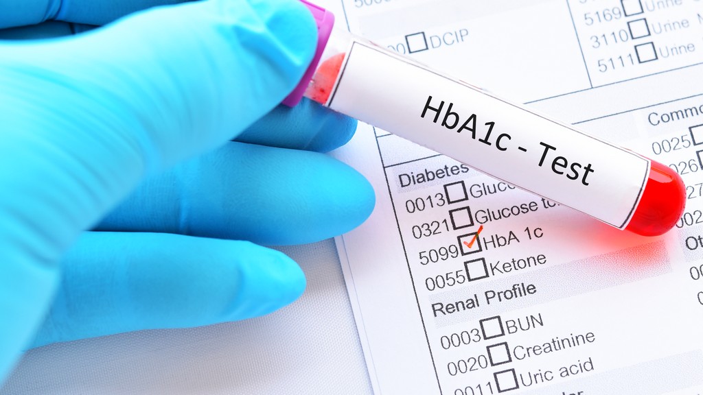 Hba1C Ölçümü Yapabilen Mobil Cihazlar