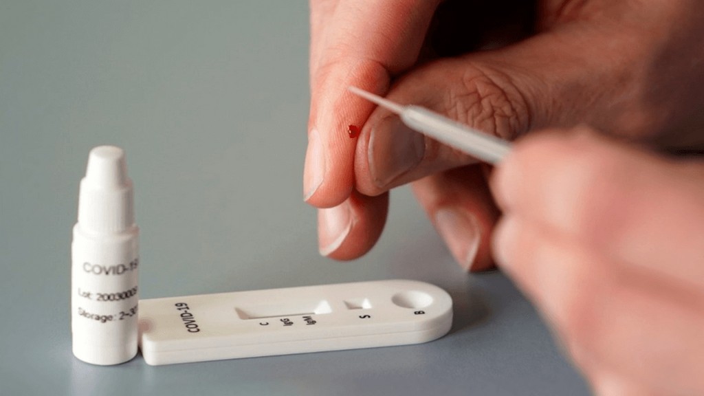 Hızlı Antijen Test Kitleri