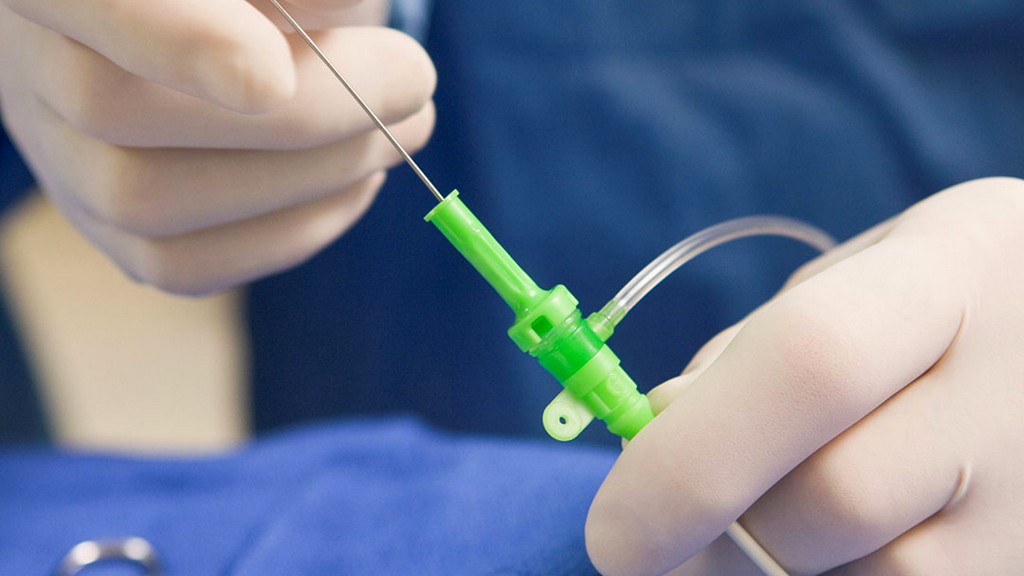 İntravasküler Ultrason (IVUS) Kateterleri
