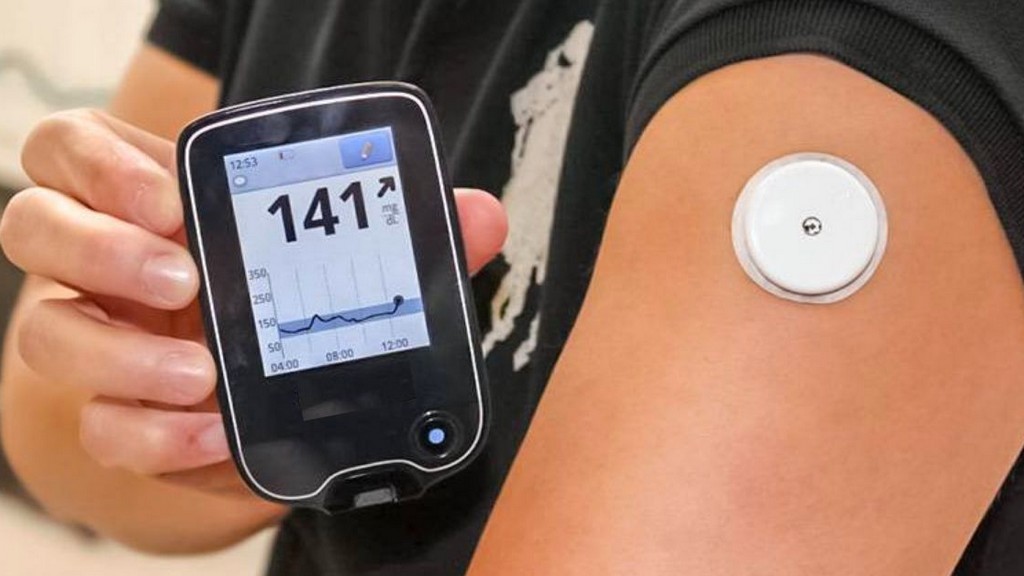 Kontinü Glukoz Monitörü (Cgm)