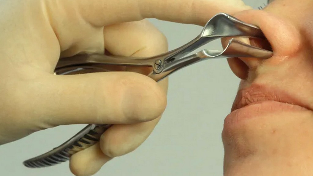 Burun Spekulumu