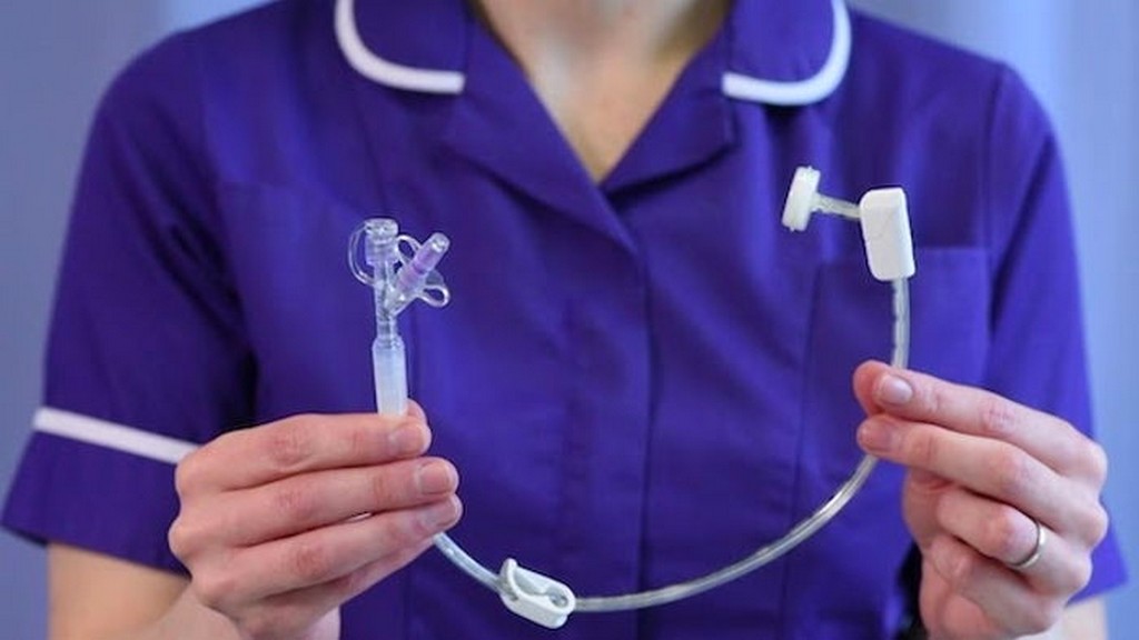 Perkütan Endoskopik Gastrostomi (PEG) Setleri