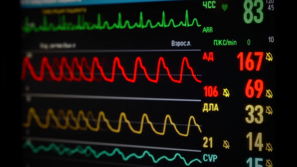 Pulmoner Basınç Monitörleri