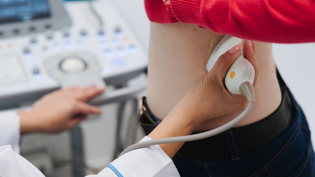 Renal Vasküler Ultrason Cihazları