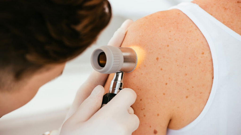 Skinelastografiler