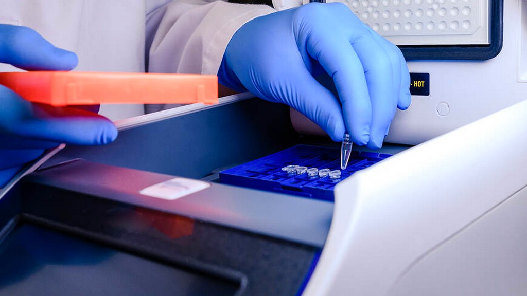 Termal Döngü Pcr Cihazı