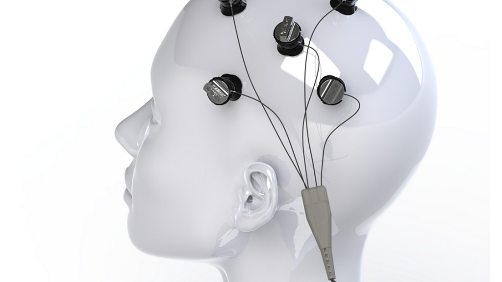 Transkraniyal Doğru Akım Stimülasyon (tDCS) Cihazları