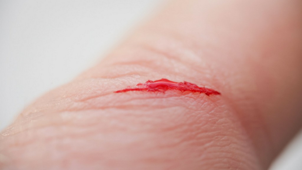 Yara Kapatıcı Sıvılar